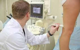 Methods for treating varicose veins in the legs in women